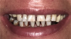 Pre-operatorio (fig. 1)