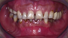 Pre-operatorio (fig. 2)