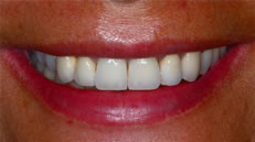 Post-operatorio (fig. 3)