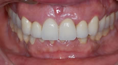 Post-operatorio (fig. 4)