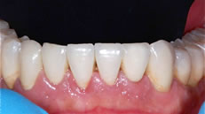 Dettaglio arcata inferiore (fig. 6)