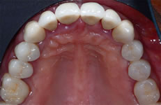 Dettaglio arcata superiore (fig. 7)