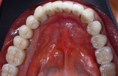 Dettaglio arcata inferiore (fig. 8)